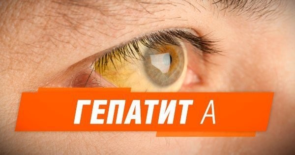 Гепатит А