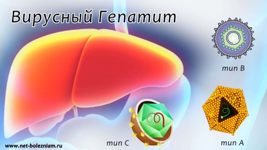 Профилактика вирусных гепатитов