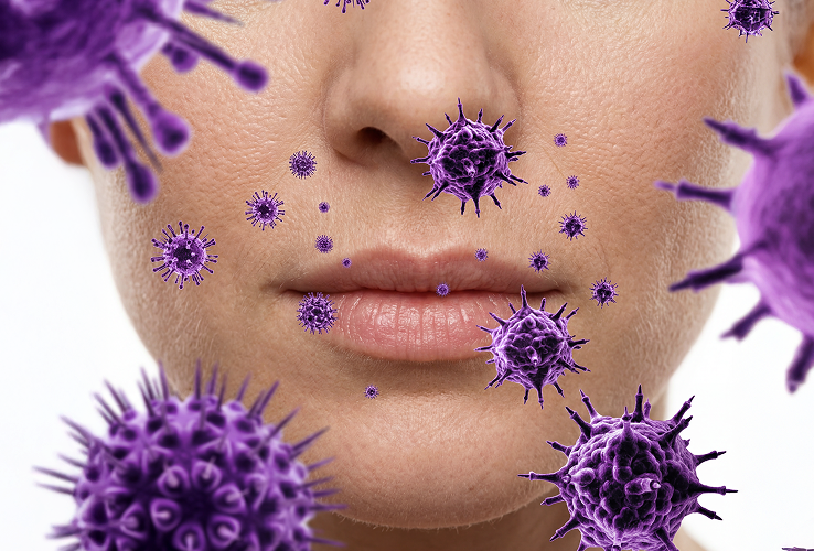 Инфицирование вирусом простого герпеса (ВПГ)